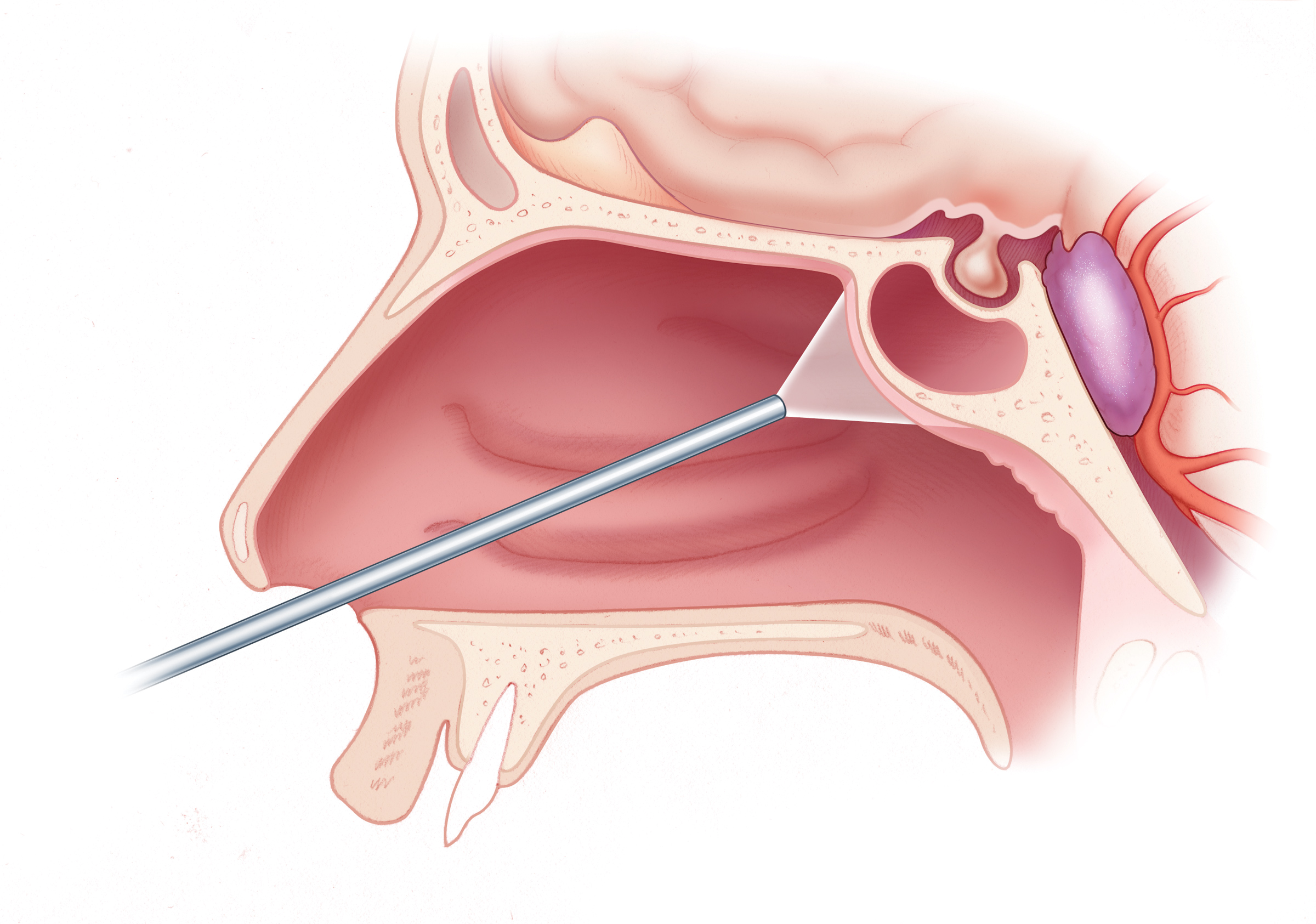 Best Cranial & Skull Base Endoscopic Surgery in Thane